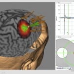 neuronavegador Unicamp