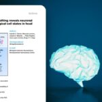 CEPID BRAINN - Blog - genômica de células únicas para estudar a displasia cortical focal - capa2