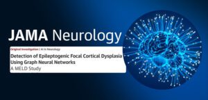 CEPID BRAINN - Blog - Pesquisa MELD Graph Epilepsia na JAMA Neurology